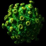 Вирус СПИДа под микроскопом